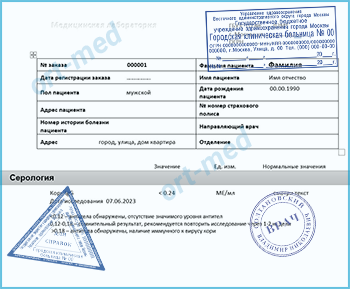 Купить тест на антитела к вирусу кори Купить справку тест на антитела к вирусу кори в Красногорске официально